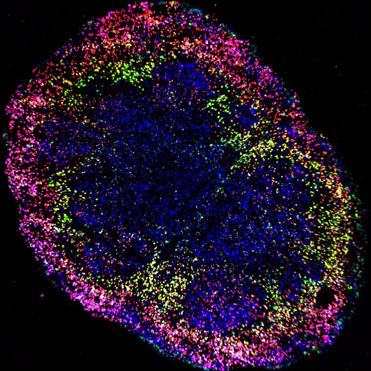 Fluorescent dots forming the outline of a sphere
