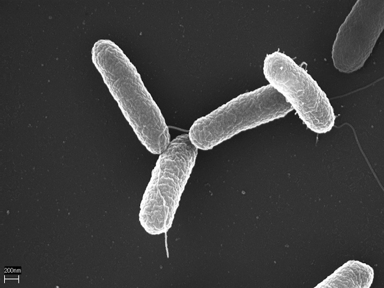 Microscopy image of six rod-shaped bacteria against a black background