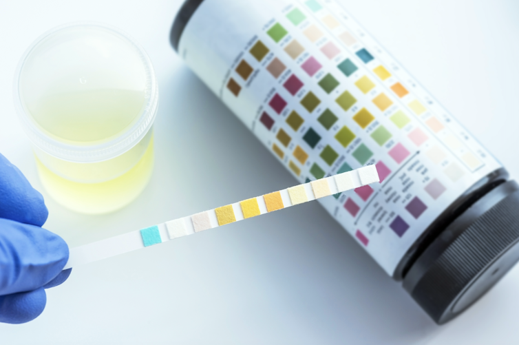 Urine analysis strips